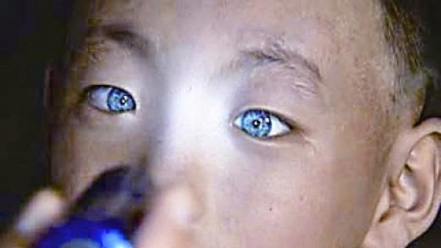 Spesies Manusia Baru Mata Bocah Ini Bisa Melihat Dalam Gelap