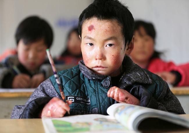 Liuchen menjadi salah satu murid terbaik di kelas | foto: copyright chinadaily.com.cn