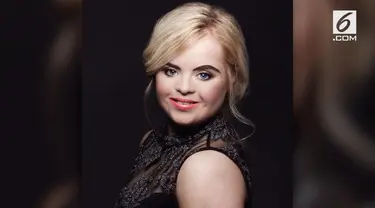 Kate Grant jadi penyandang down syndrome pertama yang mampun meraih gelar ratu kecantikan di Kontes Teen Ultimate Beauty of The World.