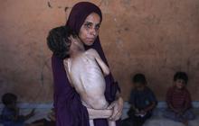 FOTO: Tubuh Kecil yang Lapar, Potret Pedih Bayi Gaza di Tengah Ancaman Kelaparan Massal