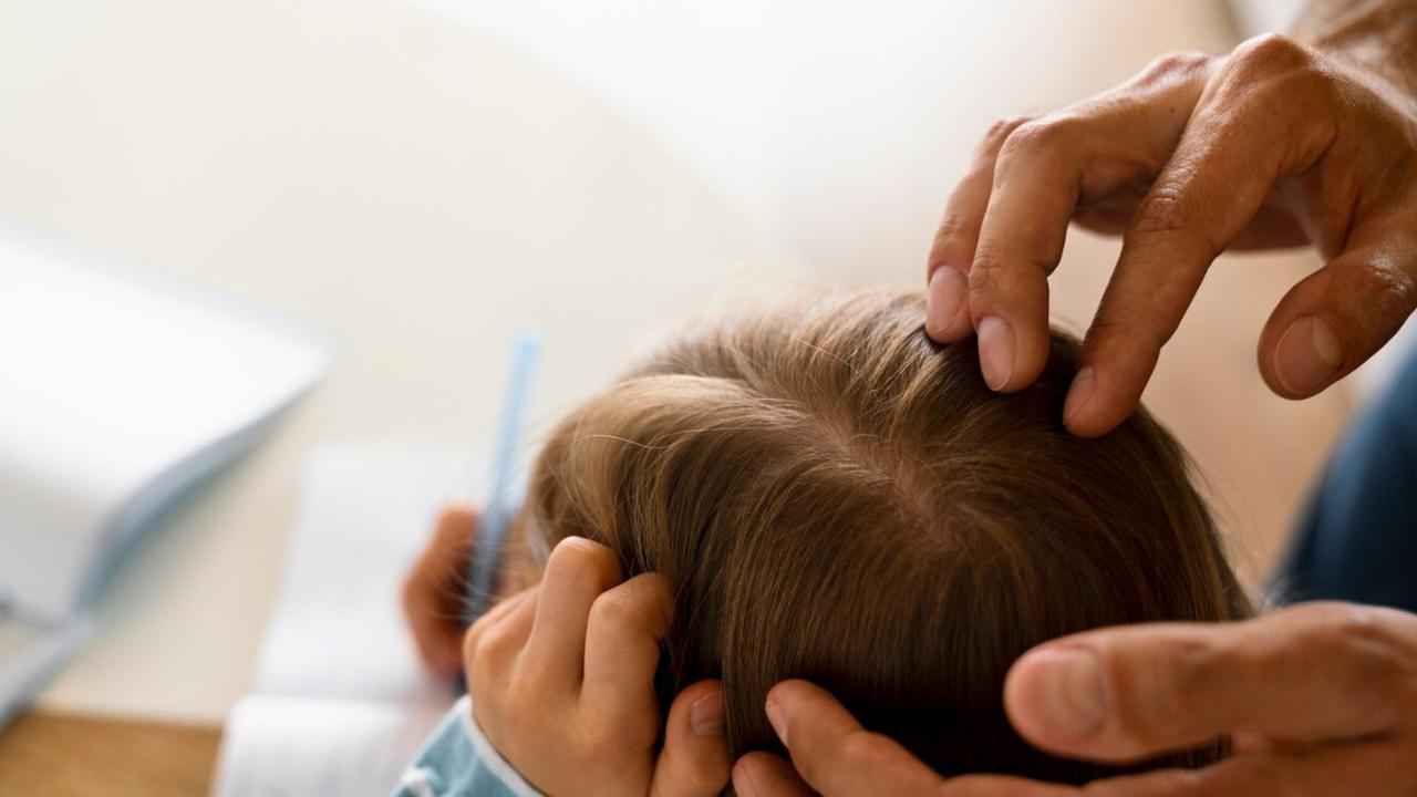Say Goodbye to Kutu Rambut: Mengatasi Kutu Rambut dalam 5 Langkah