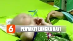 Kulit Mizyan sempat mengelupas, namun setelah dirawat kondisinya berangsur membaik.