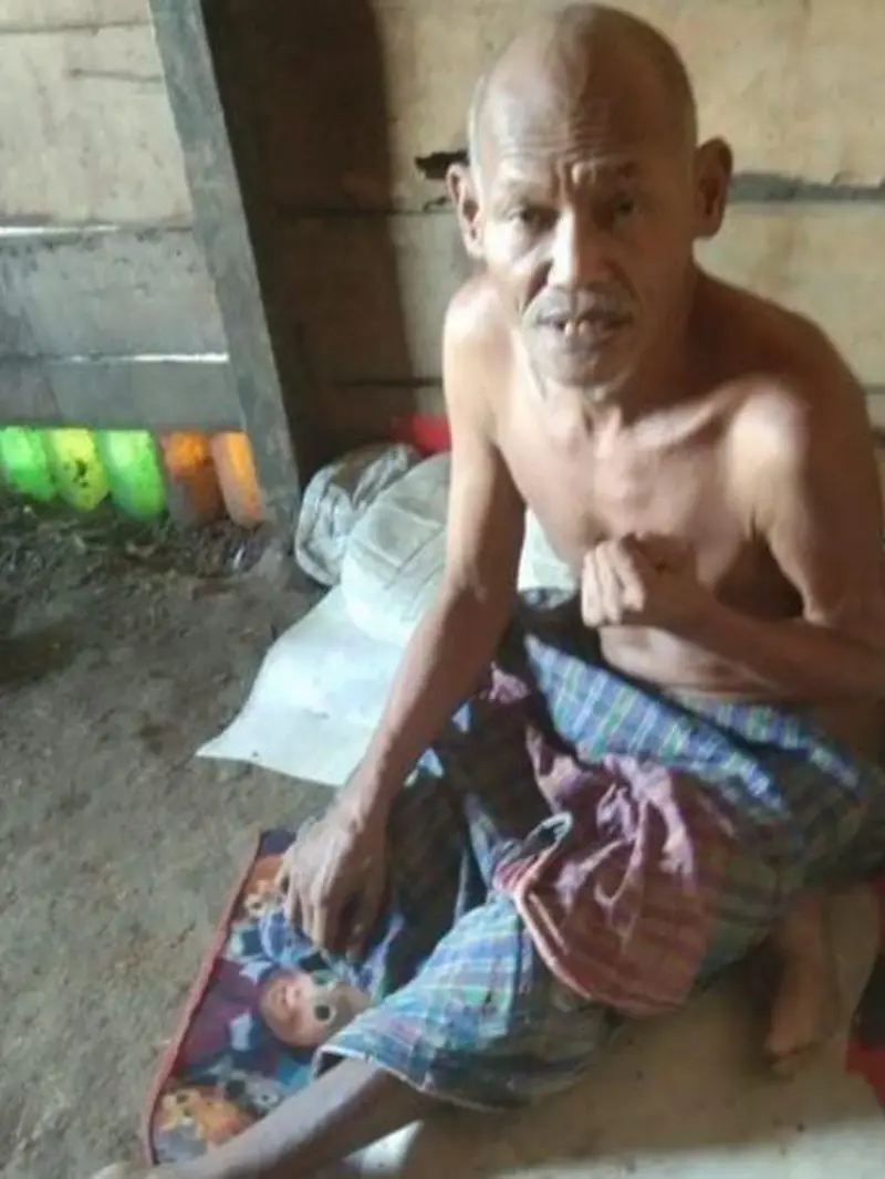 Damianus Nembot (60), warga Dusun Tolok, Desa Lenang, Kecamatan Lamba Leda Selatan, Kabupaten Manggarai Timur, sejak Maret 2020 hingga sekarang menderita stroke. (Liputan6.com/ Dionisius Wilibardus)