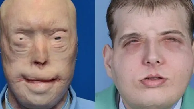 Foto: copyright Bbc.com/AP