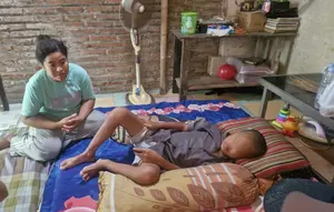 Perjuangan Remaja 14 Tahun di Kudus Melawan Tumor Otak