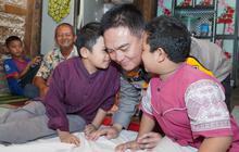 Jenderal Bintang Dua Biayai Pengobatan Kakak-Adik  Penderita Tulang Kaca hingga Pulih