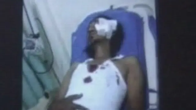 Bentrok 2 Kelompok di Depok, 2 Orang Terluka