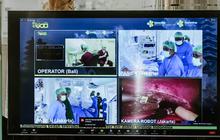 Operasi Jarak Jauh Mulai Dilakukan di Indonesia, Dokter di Bali dan Pasien di Jakarta