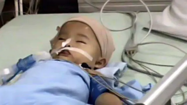 Bayi Terkena Peluru Nyasar Terbaring Lemah di ICU