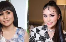 6 Potret Seleb Sebelum dan Sesudah Hilangkan Gigi Gingsul, Apakah Lebih Cocok?
