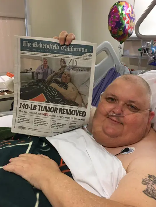 Roger Logan menunjukkan berita tentang dirinya saat tengah menjalani perawatan usai pengangkatan tumor di RS Bakersfield Memorial, California. Tumor tersebut mulai membengkak 12 tahun lalu hingga ukurannya mencapai lantai. (facebook.com/reddyrog)