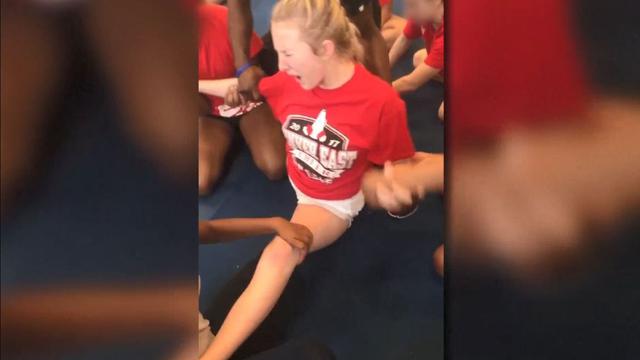 Ini 5 Tips Mencegah Cedera Akibat Split Pada Cheerleaders Health