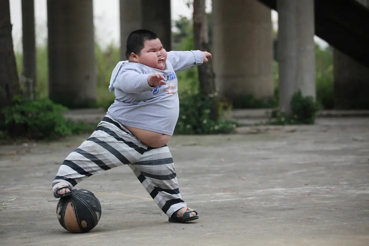 anak obesitas
