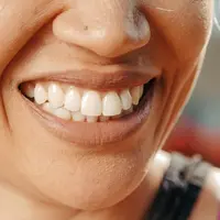 Dampak Terlalu Sering Minum Teh bagi Kesehatan Gigi