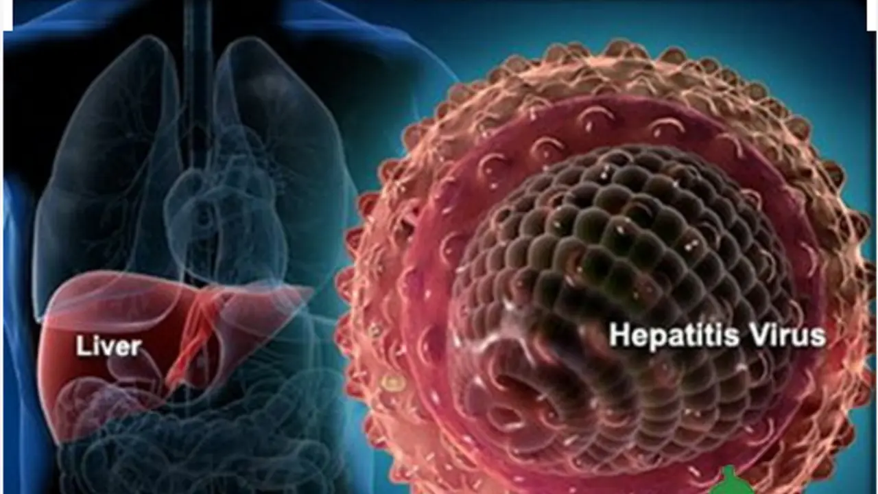 Hepatitis A