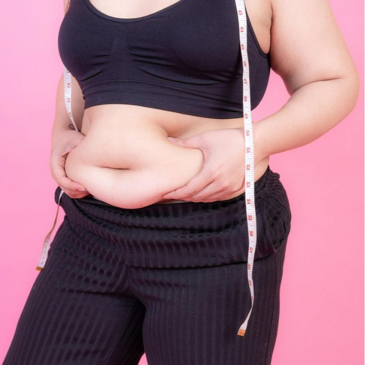 obesitas