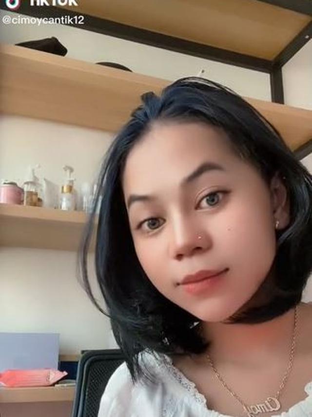 6 Potret Terbaru Cimoy Nuraini Usai Filler Hidung, Tampil Beda