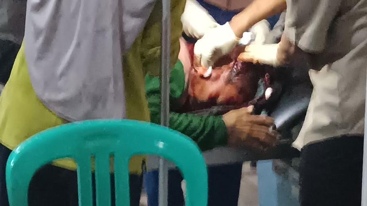 Petani 50 Tahun Diserang Harimau Hingga Kepala Luka Parah 20 Jahitan