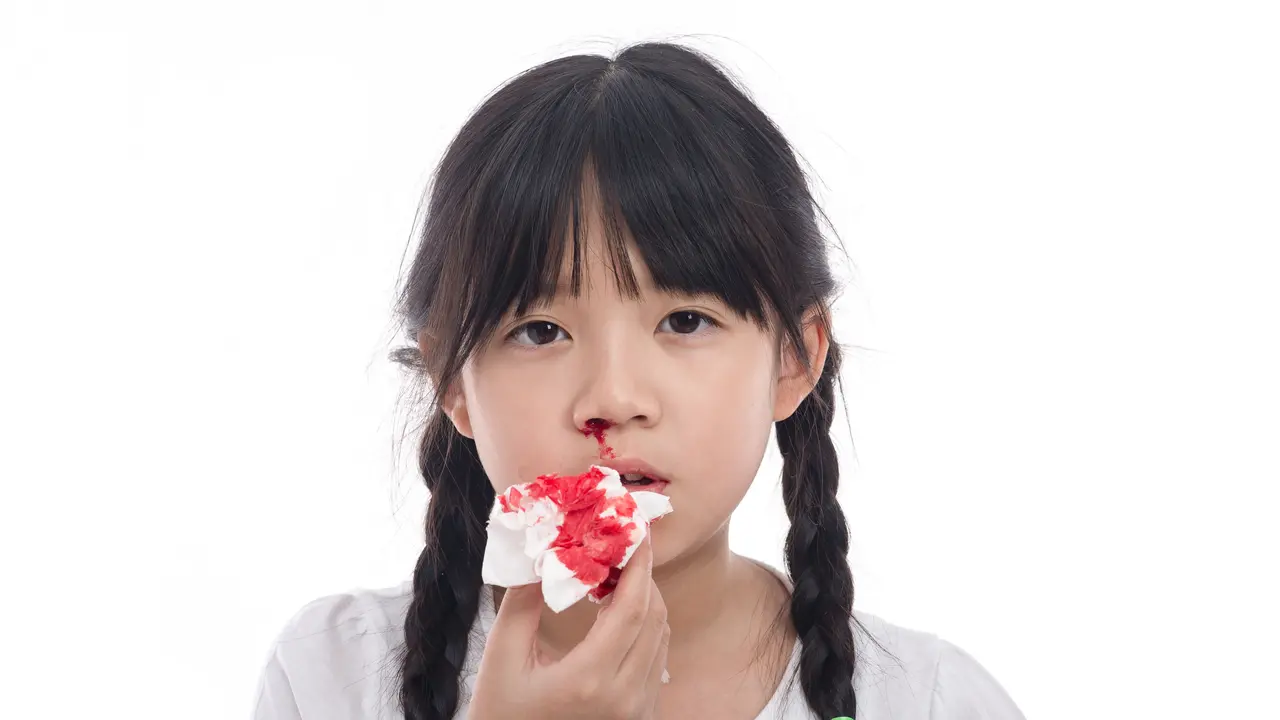 Waspada Terkena Hemofilia Jika Anak Sering Mimisan