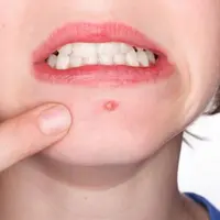 Pasti cara ini merupakan yang disukai wanita deh.