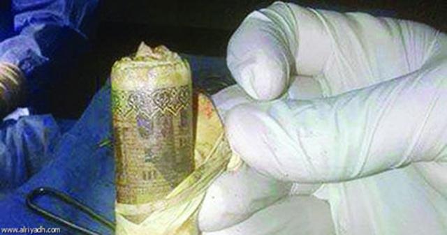 Uang yang ditemukan di dalam perut | Photo : Copyright emirates247.com 