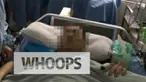 Pria 33 tahun ini kini bisa bernapas lega. Lebih dari sepuluh tahun ia menderita tumor ganas di perutnya. Namun, sekarang ia sudah bisa normal kembali setelah menjalani operasi pengangkatan tumor seberat 15 kg