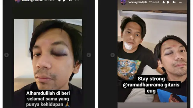 Rian D'Masiv Bersyukur Bisa Selamat dari Kecelakaan. (instagram.com/rianekkypradipta)