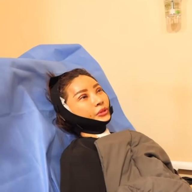 10 Potret Sarwendah Jalani Operasi Plastik di Korea Selatan, Jadi Sorotan