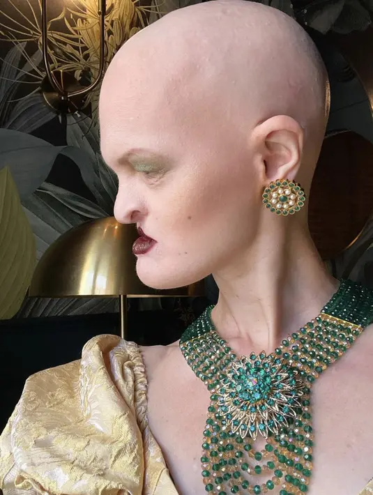 Melanie memutuskan untuk tidak menggantungkan diri pada norma kecantikan yang konvensional, dan dengan berani mengejar karier sebagai model. [Instagram/ Melanie Gaydos]