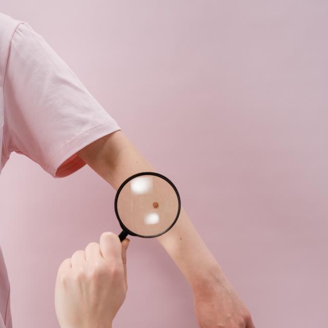 8 Arti Tahi Lalat Di Tubuh Benarkah Bisa Membawa Keberuntungan Global Liputan6 Com
