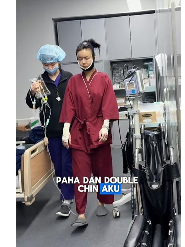 6 Potret Nita Gunawan Jalani Operasi Transfer Lemak ke Wajah Usai BB Turun 10 Kg
