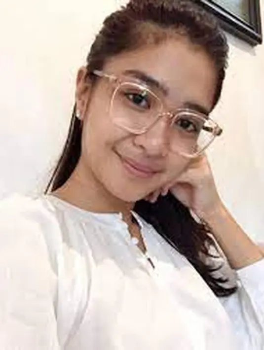 Lihat saja potret Mikha Tambayong saat sebelum menikah ini. Ia sering percaya diri tampil tanpa makeup dan memamerkan paras cantiknya lewat media sosial. Liputan6.com/IG/miktambayong)