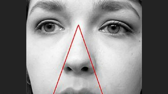 Pencet Jerawat di Dekat Bibir, Pria Ini Hampir Meninggal Dunia