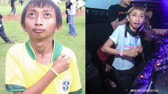 Beda Penampilan 5 Pemain Tim Kampung Bojong Ronaldowati Dulu Vs Kini (sumber: Instagram.com/omokucrut)
