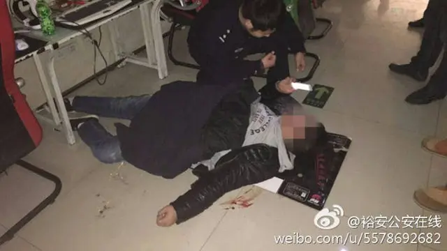 Pria yang muntah darah akibat terlalu lama bermain gim online. (Weibo)