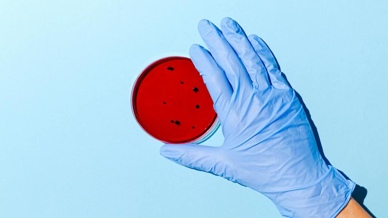 ilustrasi bacterial vaginosis