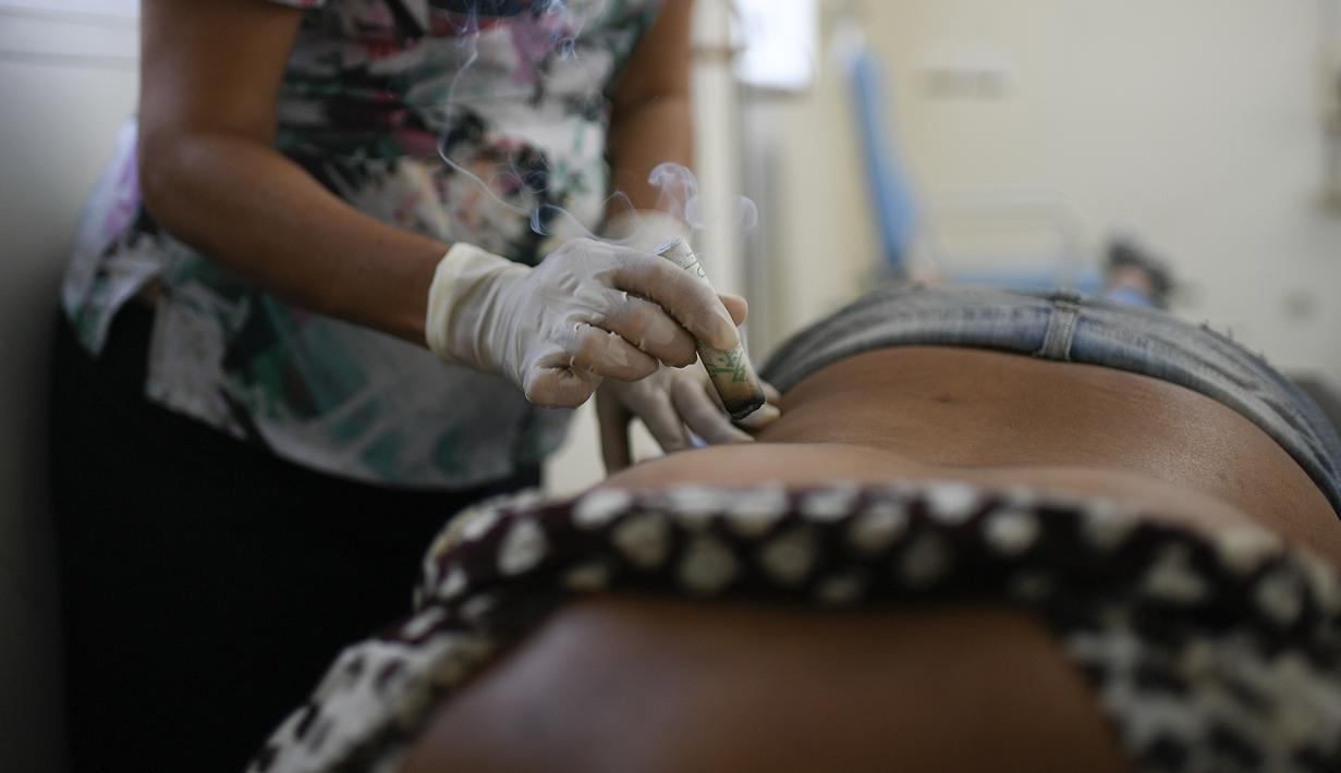 Seorang dokter melakukan terapi moksibusi, sejenis pengobatan tradisional Tiongkok, pada pasien terpapar virus Corona COVID-19 yang baru pulih di pusat kesehatan yang dikelola pemerintah di lingkungan Coche di Caracas, Venezuela pada 25 Februari 2021. (AP Photo / Matias Delacroix)