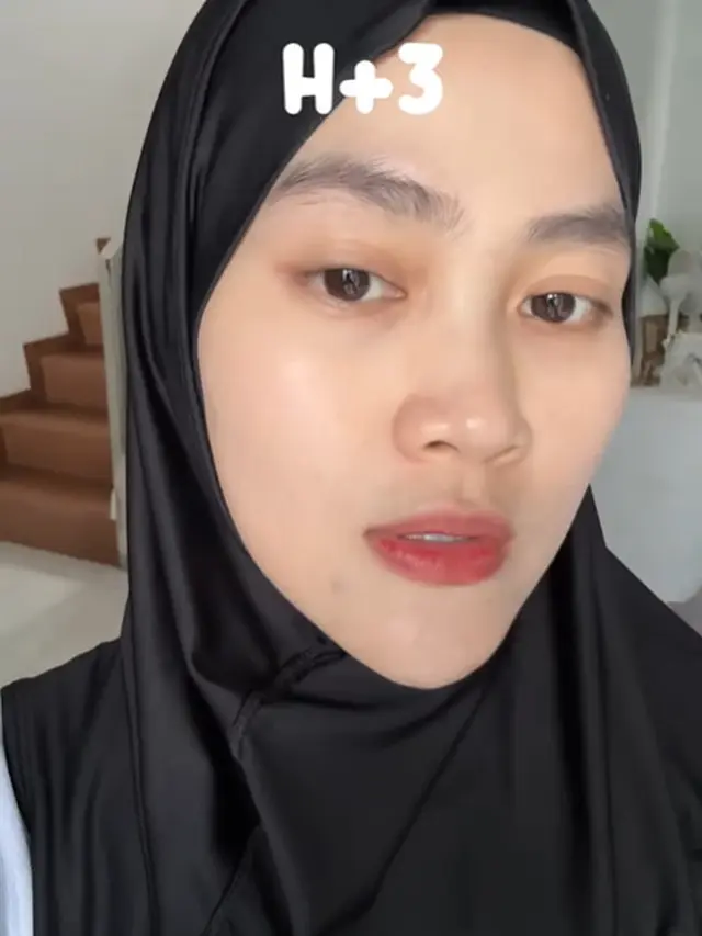 6 Potret Perubahan Wajah Henny Rahman Setelah Perawatan, Makin Cerah dan Mulus