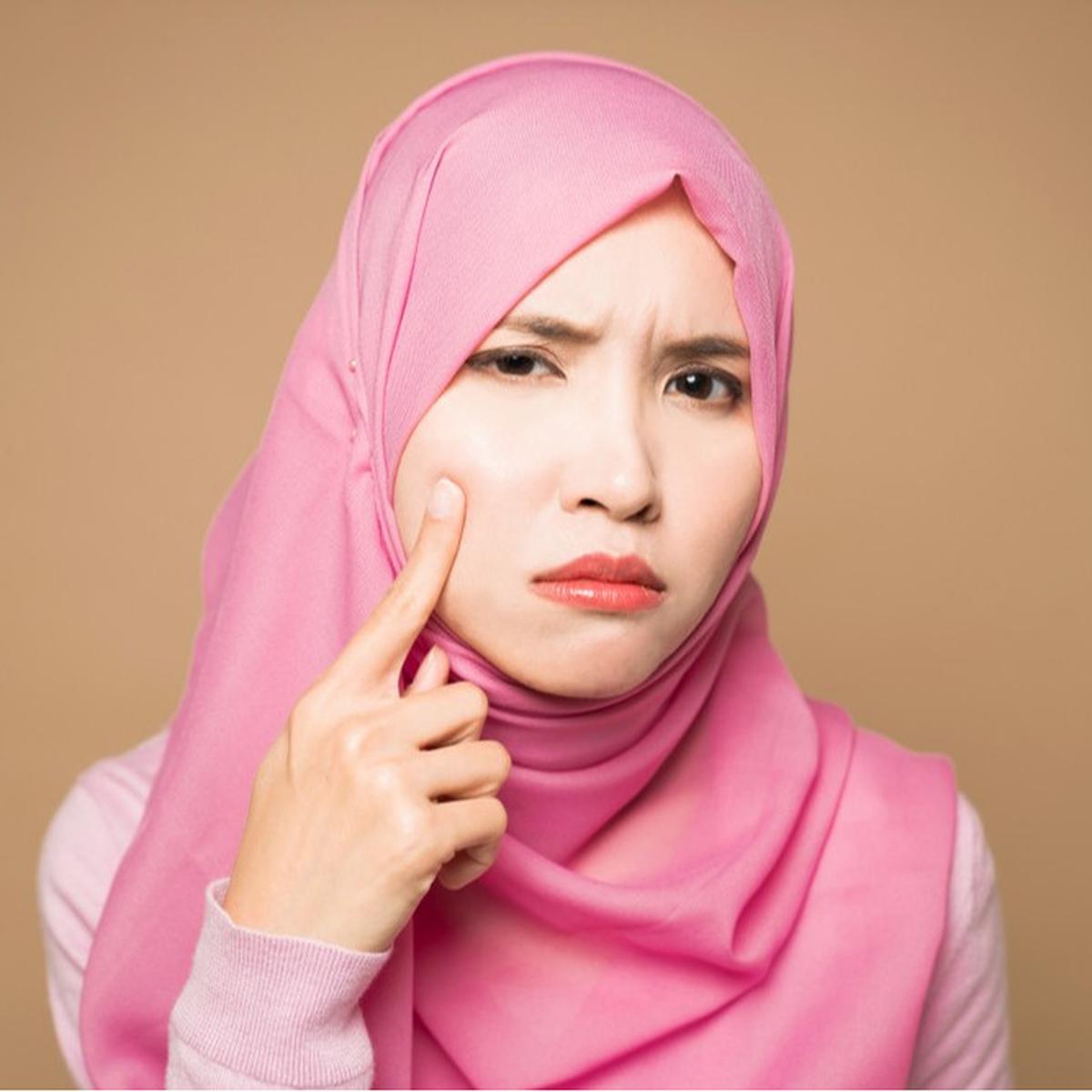 Muncul Jerawat