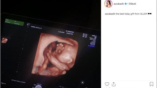 Aura Kasih (Foto: Instagram)