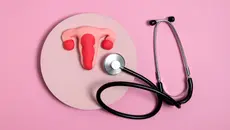 Dokter Ungkap Peluang Sembuh dari Kanker Endometrium