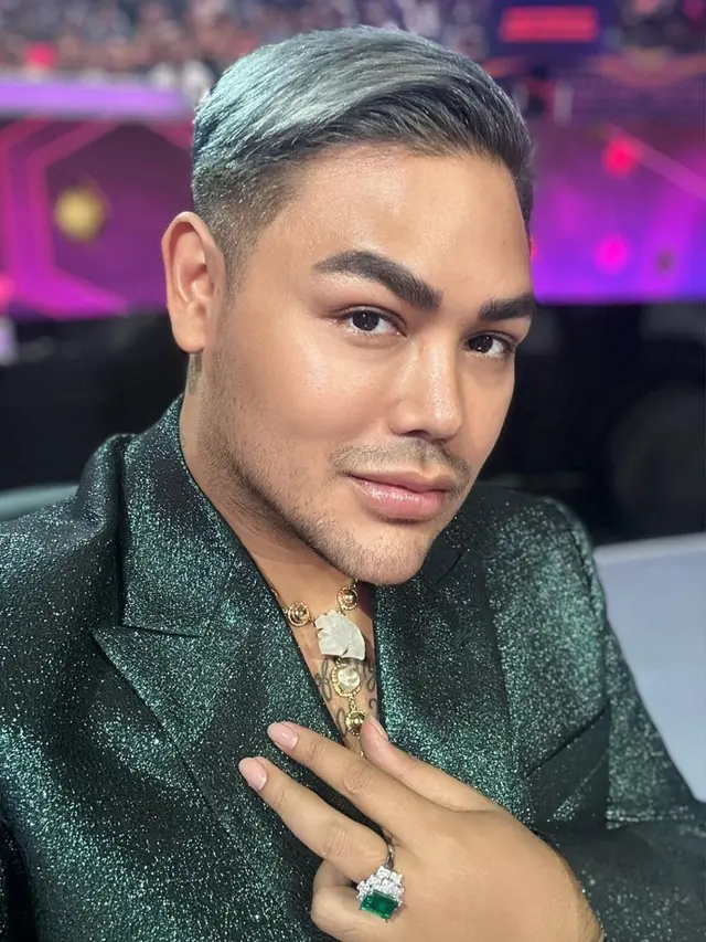 6 Potret Terbaru Ivan Gunawan yang Bibirnya Disebut Makin Tebal Oleh Netizen