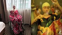 6 Potret Lucinta Luna Belajar Berdiri Usai Operasi Gergaji Rahang dan Potong Tulang Ekor