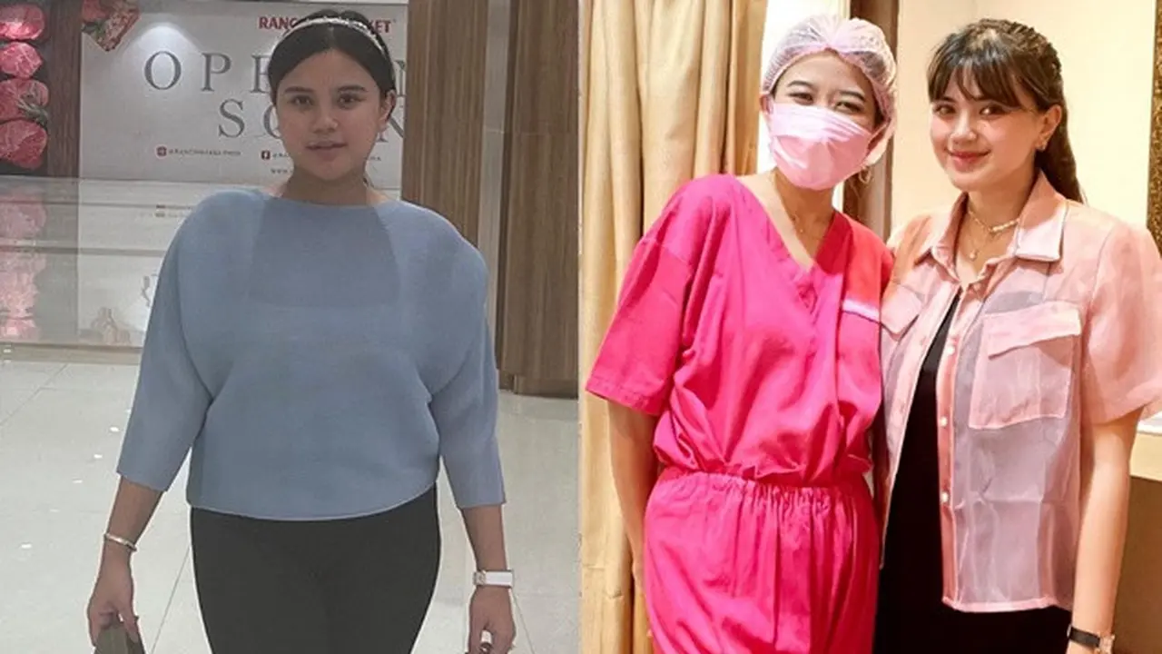 Turun 12 Kg, Ini 6 Potret Terbaru Audi Marissa yang Makin Langsing