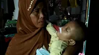 Rizki, bocah asal Cirebon mengalami koma selama empat tahun karena sakit Meningitis yang dideritanya (Liputan6.com / Panji Prayitno)