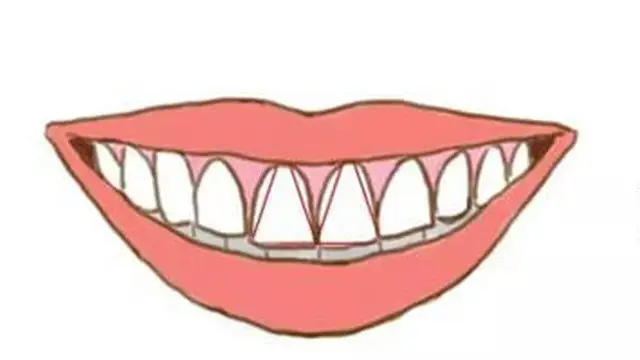 Ilustrasi gigi depan
