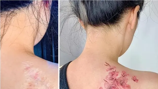 Kreasi Bekas Luka Jadi Lukisan Tato