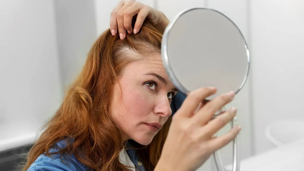 Penyebab dan Cara Menanganinya Hair Line Mulai Mundur (photo by freepik)