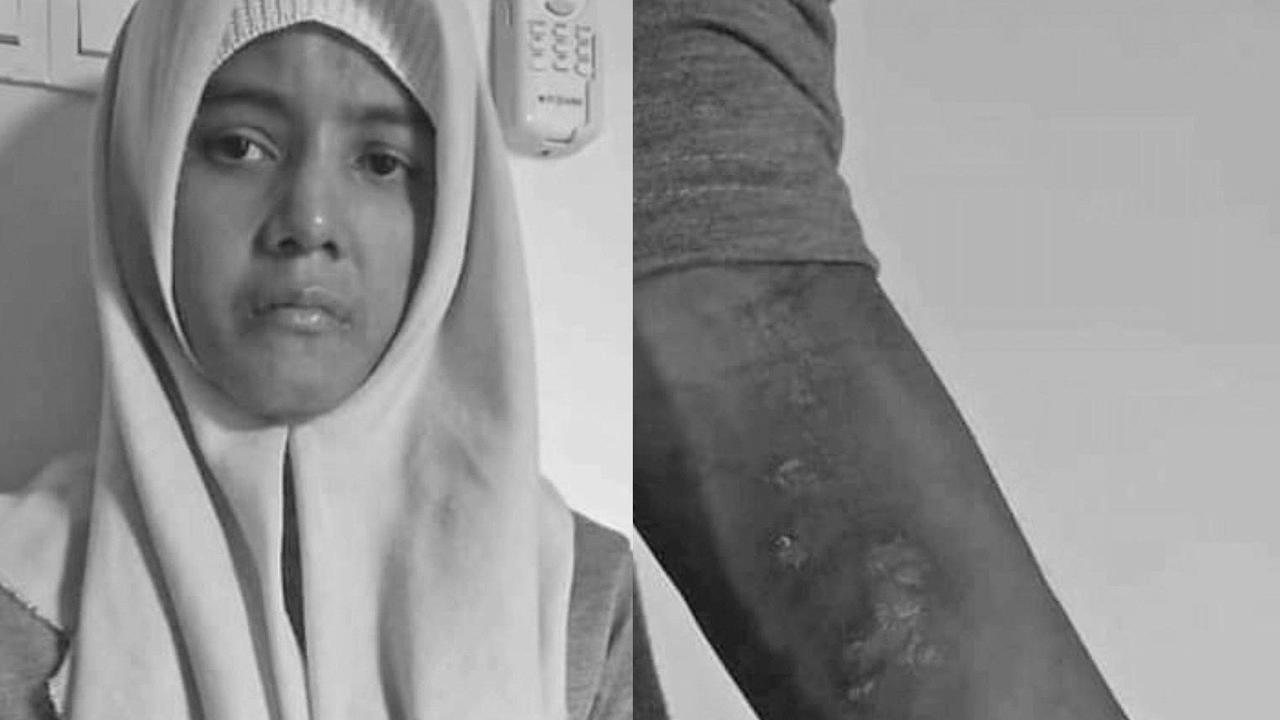 TKW Korban Penyiksaan