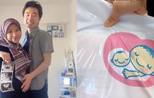 Cewek Ini Bagikan Pengalaman Hamil Selama di Jepang, Ternyata Dapat Segepok Uang hingga Informasi Berharga